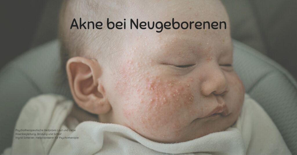 Akne bei Neugeborenen. Weinen beim Anpassungsstörungen und Regulationsstörung. Psychotherapeutische Heilpraxis Laut und Liebe Kisenbegleitung, Bindung und Schlaf Ingrid Scherzer, Heilpraktikerin für Psychotherapie Schreibaby, Kolik, Highneedbaby, Regulationsstörung.